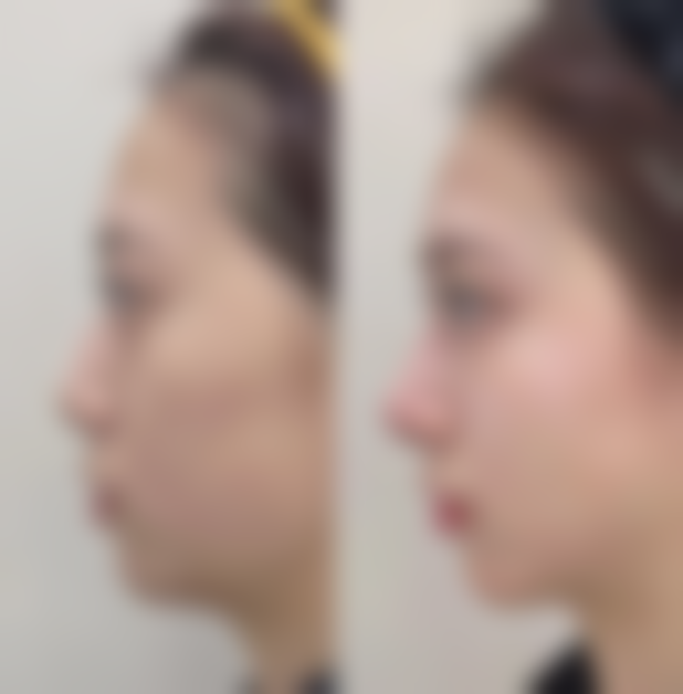 未澜康荟医疗美容门诊部价格表/收费标准一览