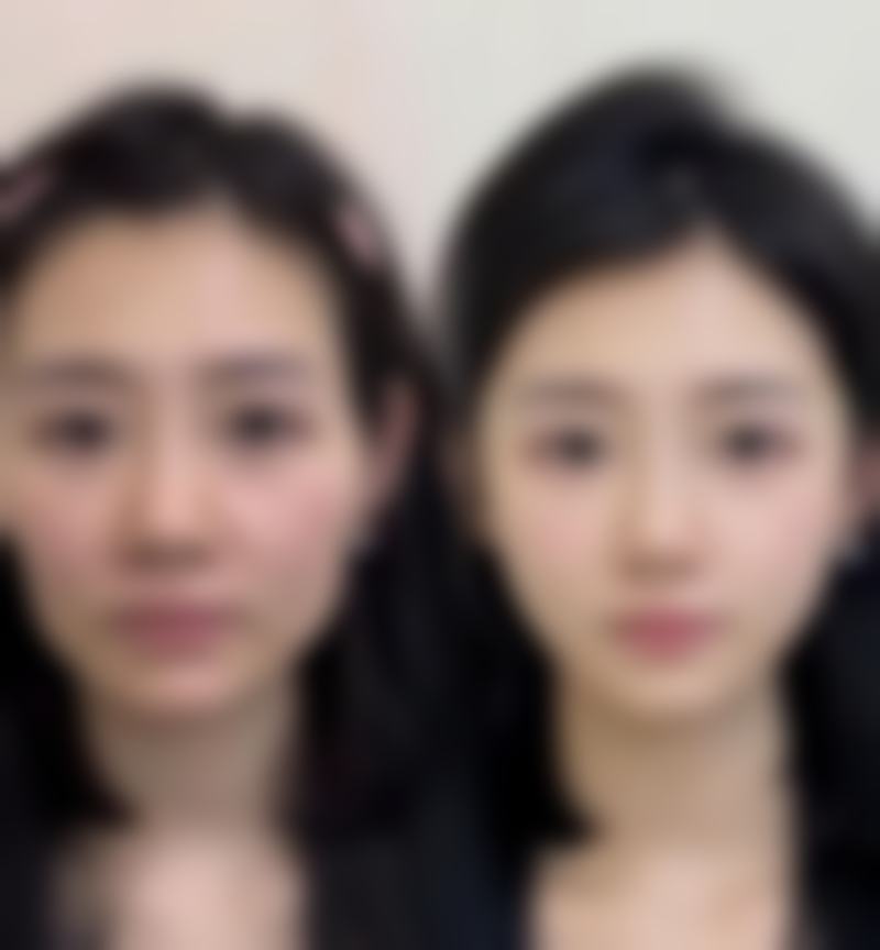 上海九龙医院阴蒂饱满胶原项目避坑指南