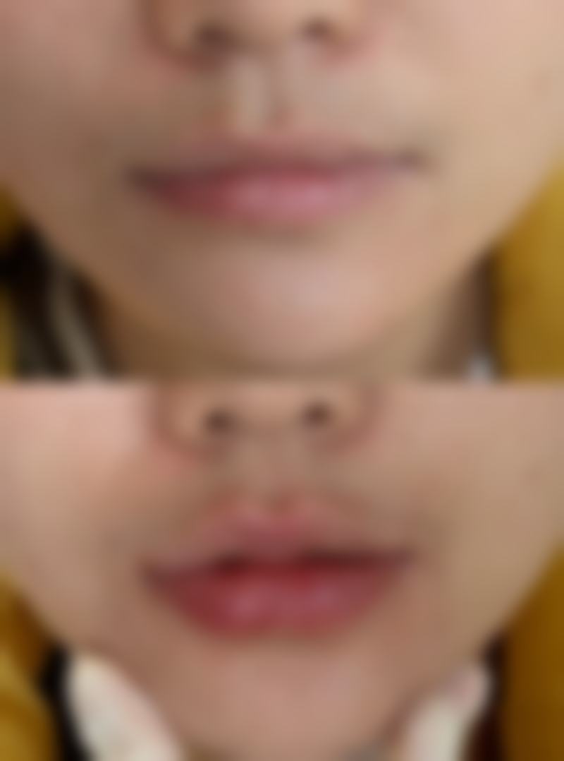 未澜康荟医疗美容门诊部特色诊疗项目