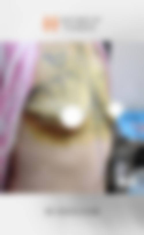 自体脂肪隆胸适合哪些人群?