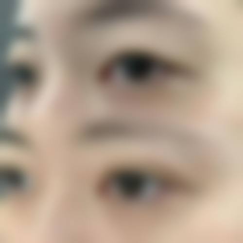 术后护理防感染的要点解析