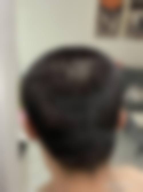 五、大同伊美康整形美容诊所医院特色技术及优质服务