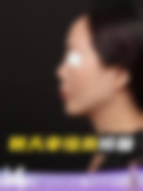 十、相关科普内容推荐:面部情绪美学提拉注射