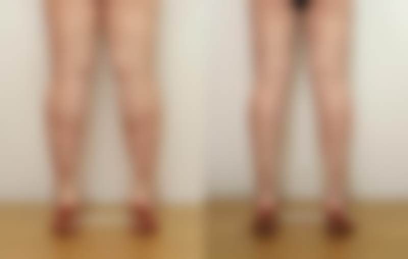 韩国sage医院李敬秀怎么预约面诊？官网/IG/电话3种方式任选，20年院长亲诊超放心