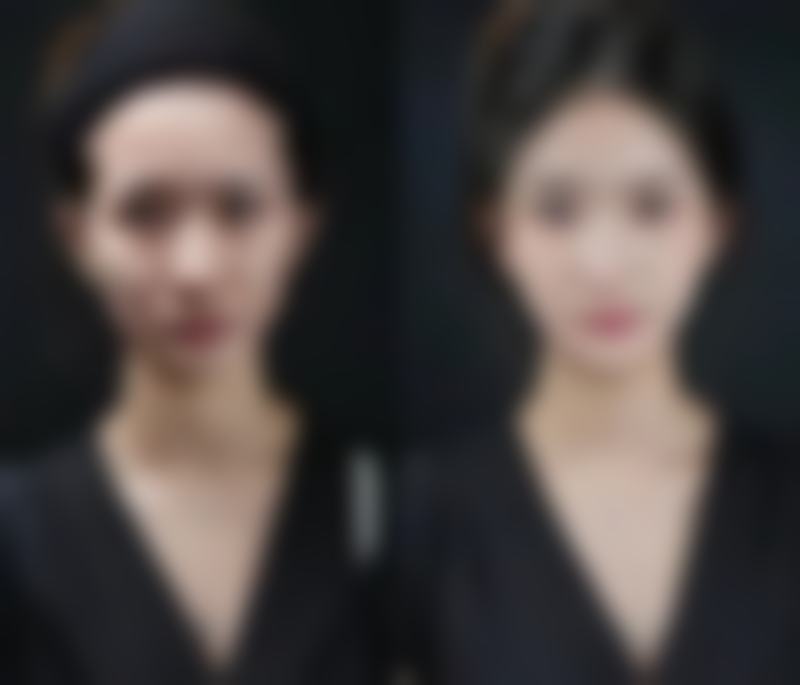 七、大同伊美康整形美容诊所口碑如何