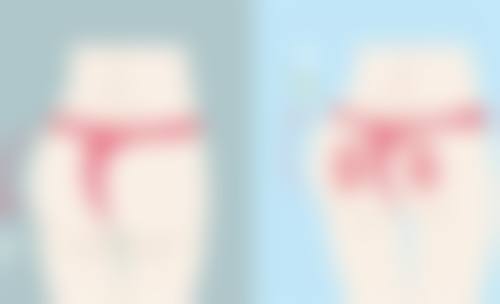 种植发常见并发症或后遗问题，在临床中如何理解其发生概率？