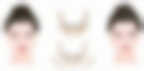 种植发有风险吗？有！选对医院医生+术前术后护理，风险可降至5%以内