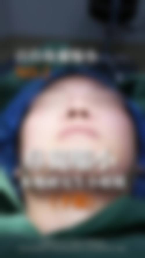 线雕隆鼻真的好吗？术后恢复快仅需 1 - 2 周、价格 5000 - 10000 元，效果自然值得选！看成功案例见证神奇效果 