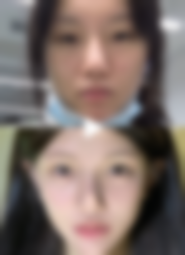 哪些情况通常不被认为是合适指征？