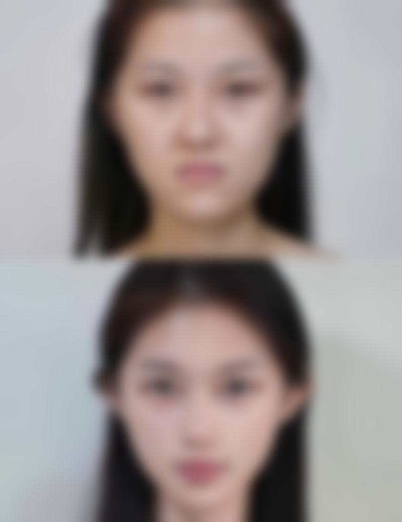 选对医院医生降低种植发风险的理由