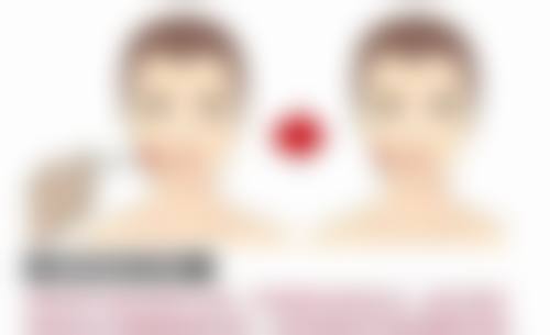 瘦脸针有长效的吗？有！维持3 - 5年、成分稳定效果显著的长效瘦脸针揭秘 