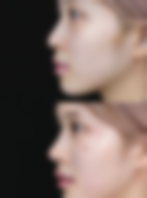 BeautyBar整形外科医院面部整形技术优势