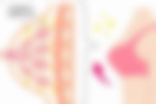 二、注射玻尿酸隆胸通常在什么阶段被纳入医疗选择范围？