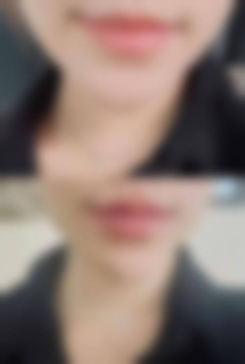 二、广州美莱医学美容医院是正规医院