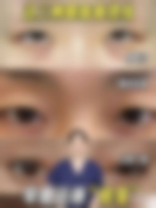 九、广州美莱医学美容医院患者常见问题解答（精选 ）