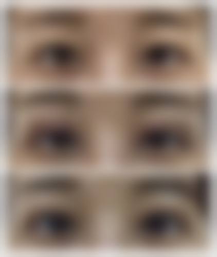 七、怎么快速的消除眼袋？按摩、冰敷加眼霜，三招结合的费用为何差异明显？价格区间如何形成？