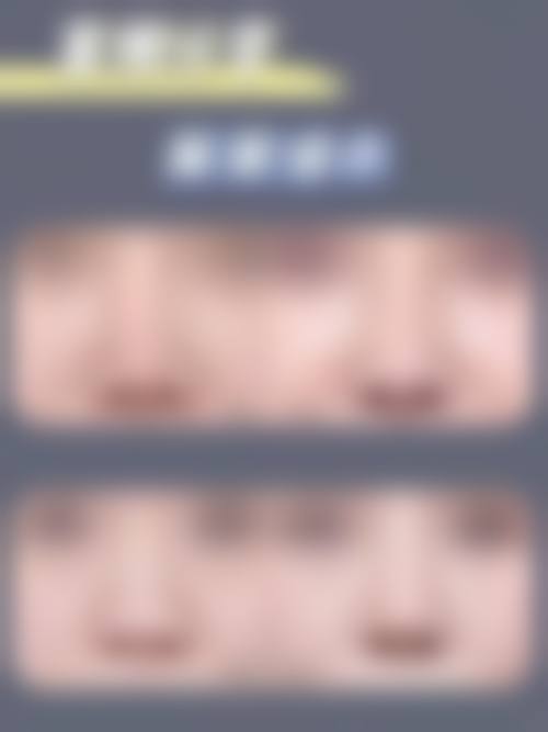 十一、三明市永安总医院医疗美容科口碑评价