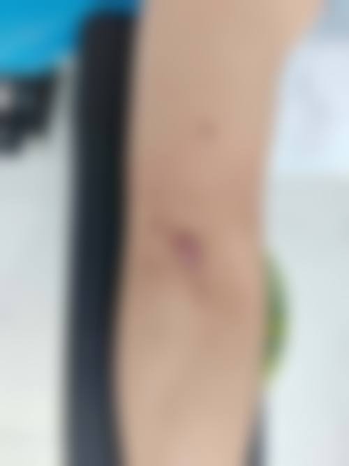 四、三明市永安总医院医疗美容科诊疗项目