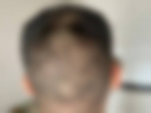 三、中山曙光医疗美容开展项目