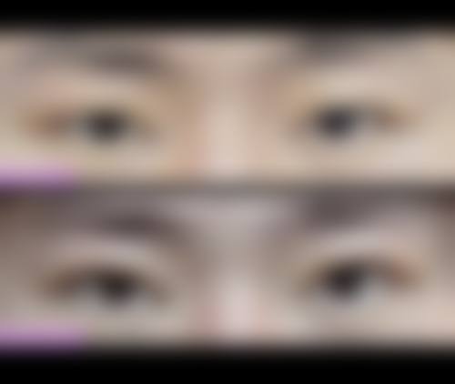 十一、在决定怎么快速的消除眼袋？按摩、冰敷加眼霜，三招结合前，普通用户更容易忽略的关键信息