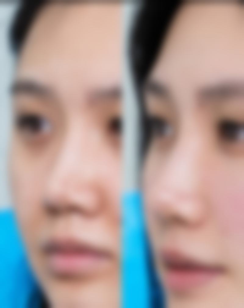 五、李挺医生预约挂号指南