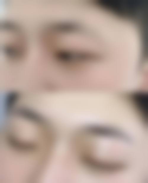 赤峰丽都医院植发中 心诊疗项目