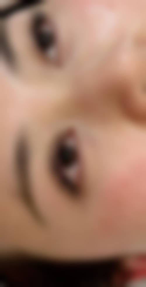 赤峰丽都医院植发中 心正规吗？