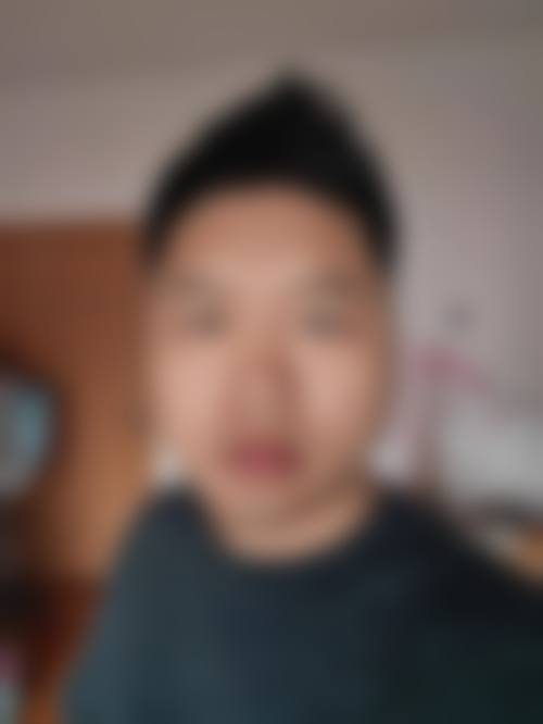 赤峰丽都医院植发中 心患者常见问题解答（精选 ）