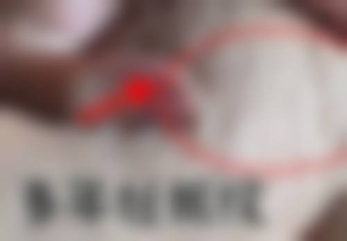 五、上海诺倍丽医疗美容诊所价格表区间/收费标准说明