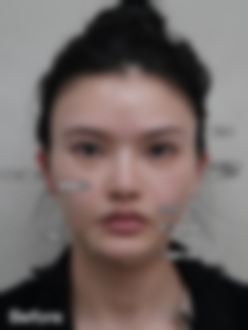 普通用户判断西安艺星闫运涛医生报价是否合理的3个方法