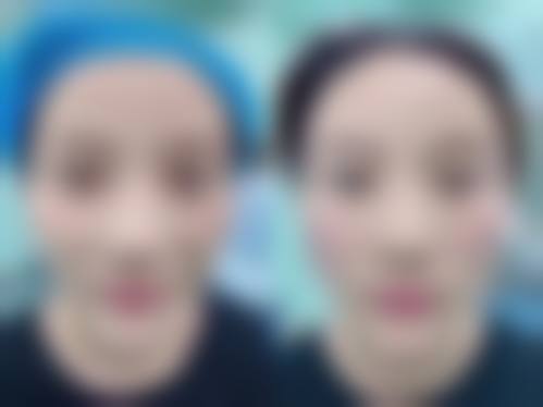 除了张宇恒，这些鼻综合/吸脂医生也值得约