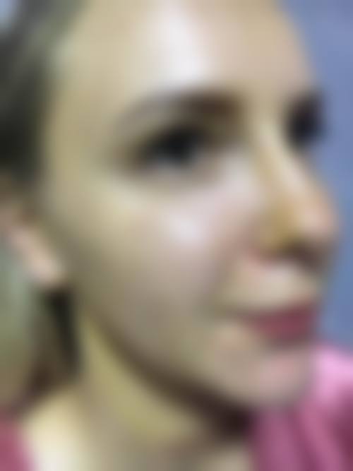 徐昇源医生口碑点评反馈