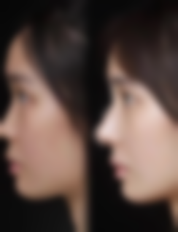 三、裴元培医生技术水平高