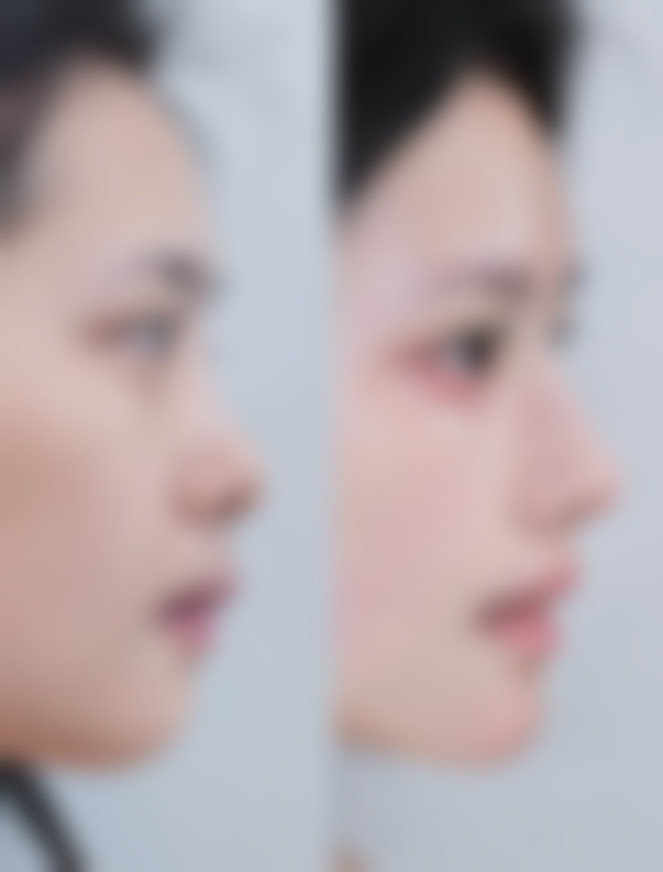 原理优势是否会同时带来新的风险或限制