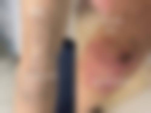 天津祥云皮肤病医院整形科特色诊疗项目