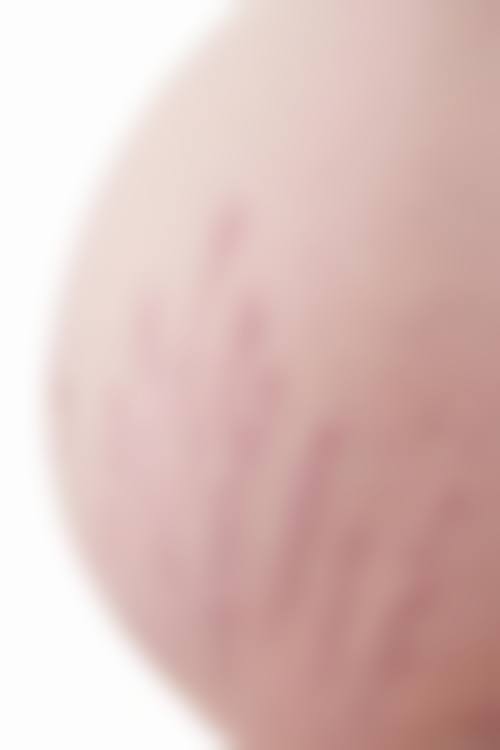 十、患者常见问题解答（精选 ）