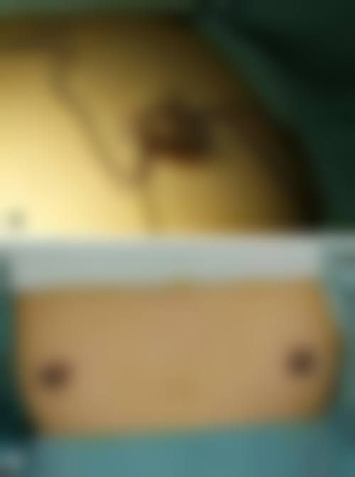 医院医生的选择要点或推荐名单（如有）