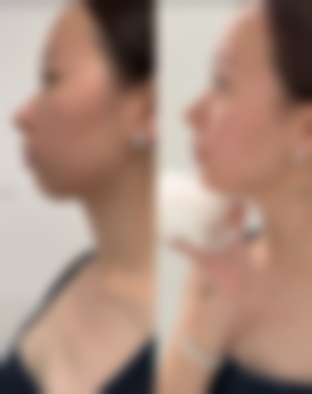 三：温公佳医生擅长项目介绍