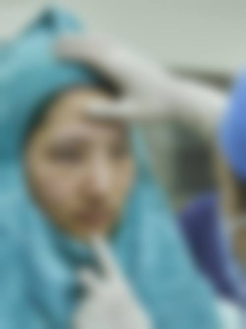 眼袋治疗医院与医生选择中，哪些因素更关键？及医院医生推荐！