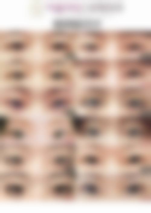 睡眠充足眼袋会减轻吗