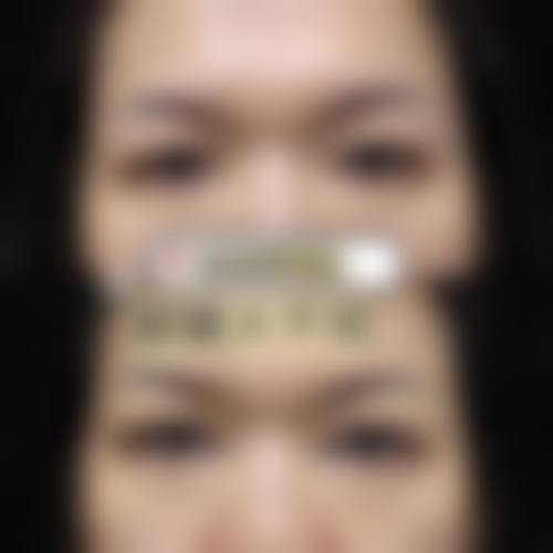 冬瓜可以消眼袋吗？医生揭秘吃冬瓜汤+敷冬瓜片双用法，7天缓解水肿型眼袋！