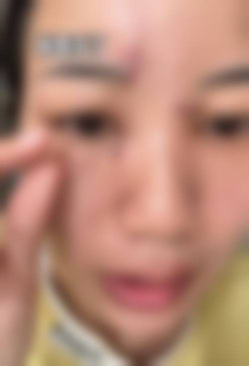 患者常见问题解答(精选 )