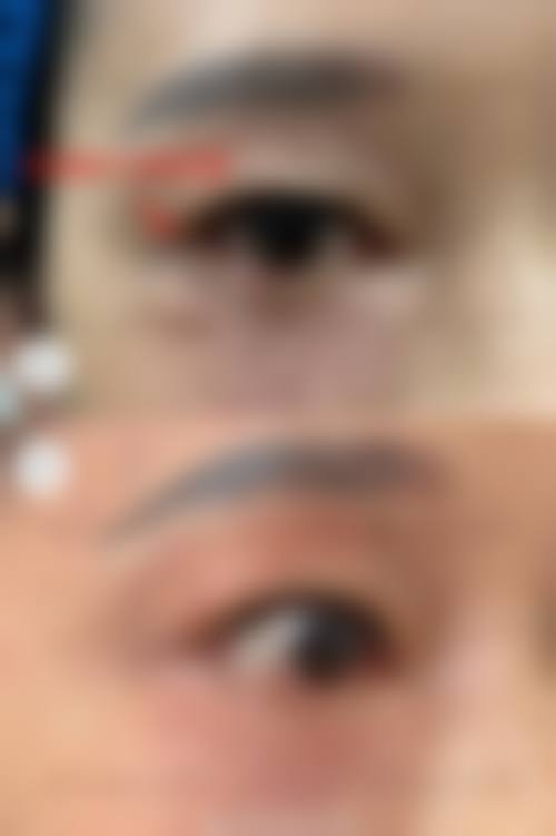 从医学角度看,冬瓜可以消眼袋吗的核心目的是什么?