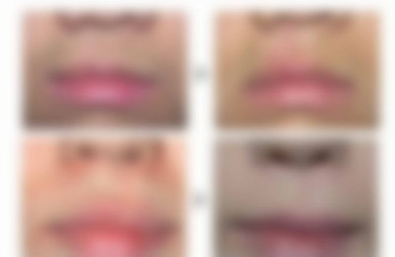 二、杨国明医生擅长项目