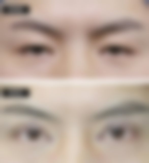 冬瓜可以消眼袋吗所依赖的技术 / 材料,现实优势与限制并存