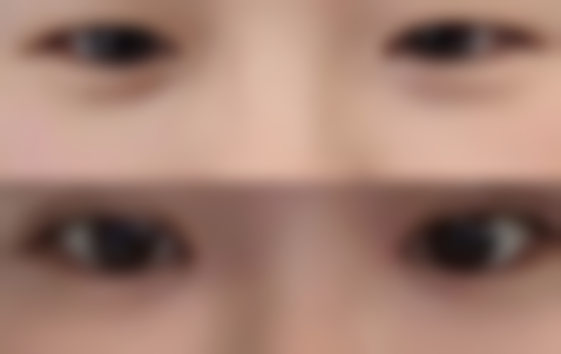 在实际操作中,冬瓜可以消眼袋吗更适合哪些人?