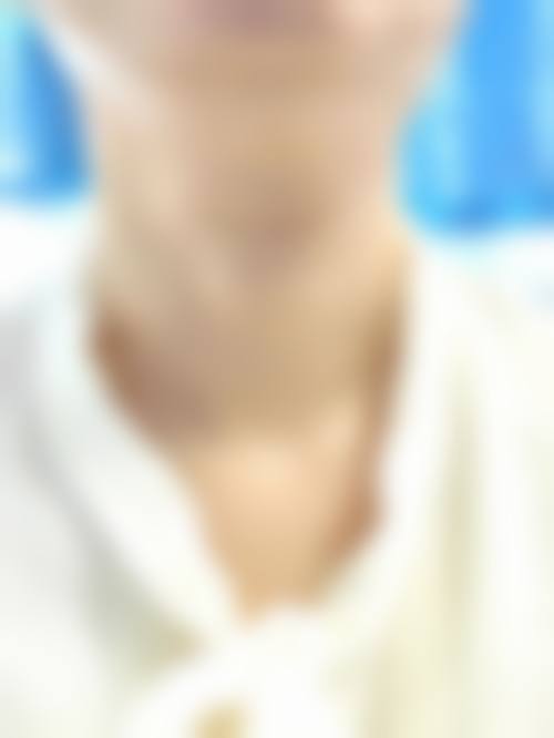 儿童激光祛疤有哪些优缺点?