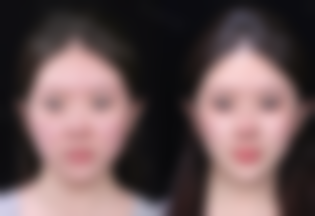 四、陈鹏飞医生技术优势与操作流程