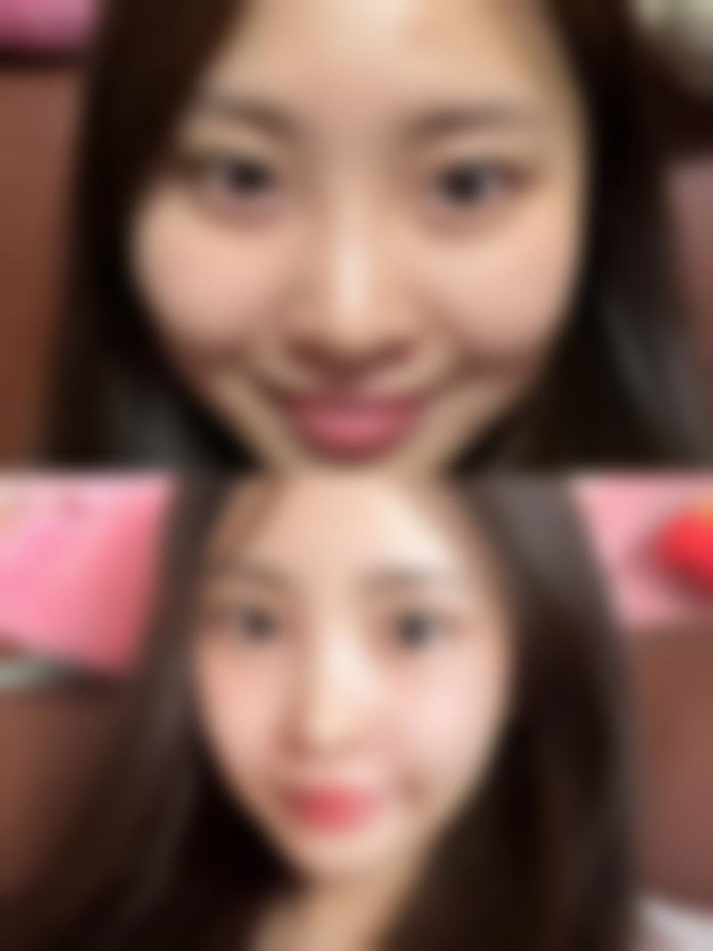 从医学角度看，去眼袋手术的风险主要集中在哪些环节？