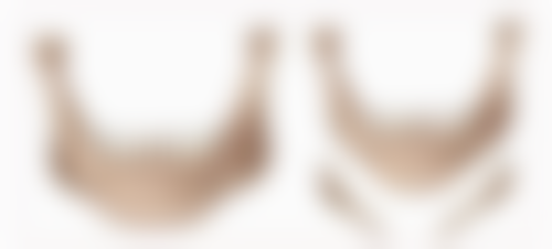 有真实的患者实例吗？